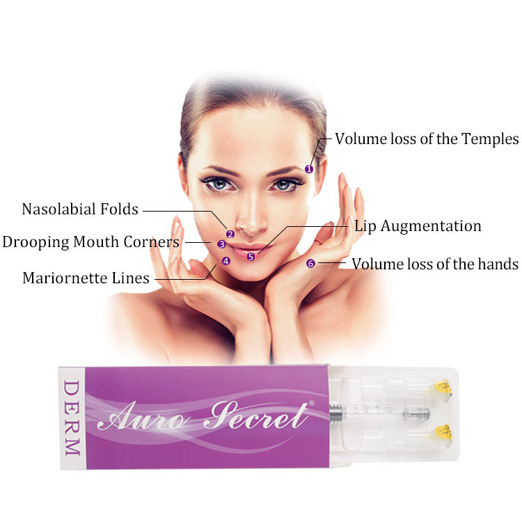 Best effect acido hialuronico reticulado cross linked hyaluronic acid