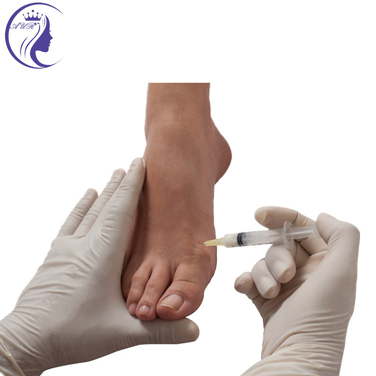 hot in uk Non Cross Linked Hyaluronic Acid Needling Neuramis Injections