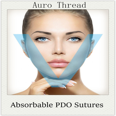 Distributors Wanted Medical Absorbable Pdo Cog Threads Blunt Cannula/L Needle