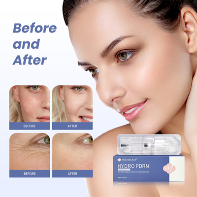 non cross linked hyaluronate promote skin regeneration hydro pdrn skinbooster