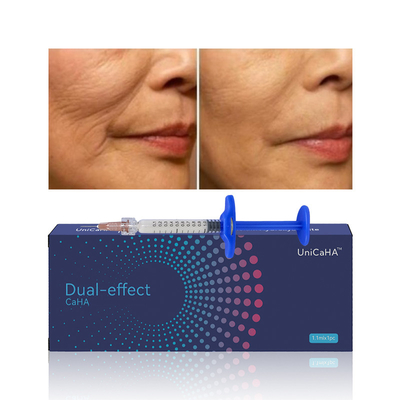 Safe Facial injection 1.1ml Hyaluronic acid Calcium Hydroxyapatite dermal filler